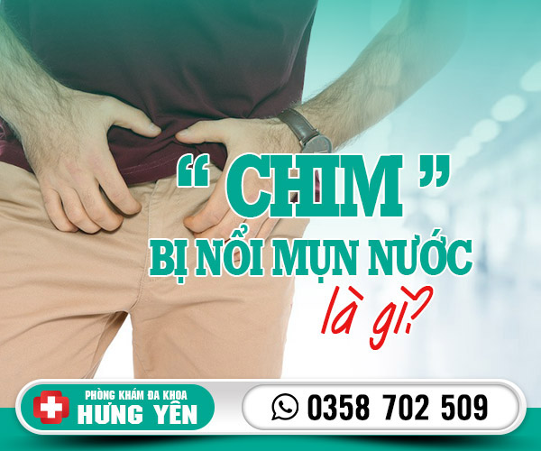 Chim bị nổi mụn nước là gì