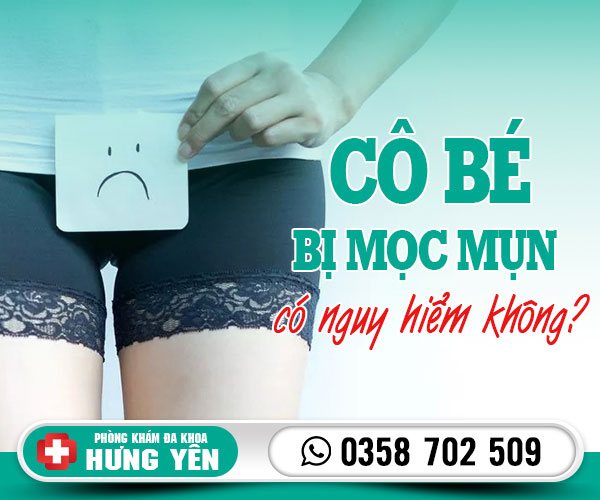 Cô bé bị mọc mụn có nguy hiểm không