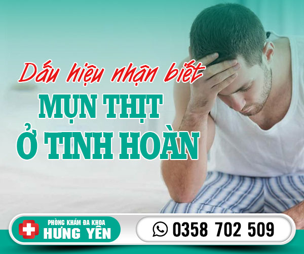 Dấu hiệu nhận biết mụn thịt ở tinh hoàn