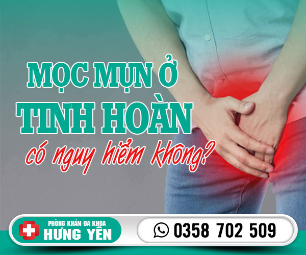 Mụn mọc ở tinh hoàn có nguy hiểm không