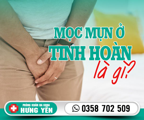 Mọc mụn ở tinh hoàn là gì