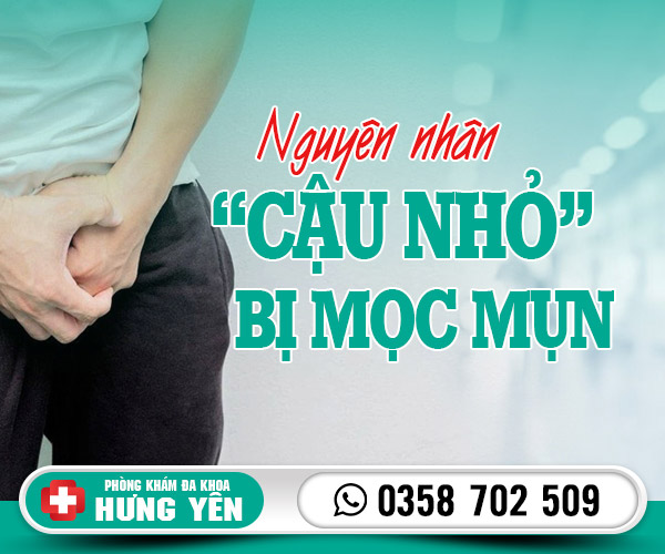 Nguyên nhân mậu nhỏ bị mọc mụn