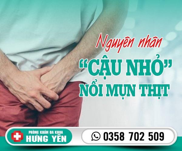 Nguyên nhân cậu nhỏ nổi mụn thịt