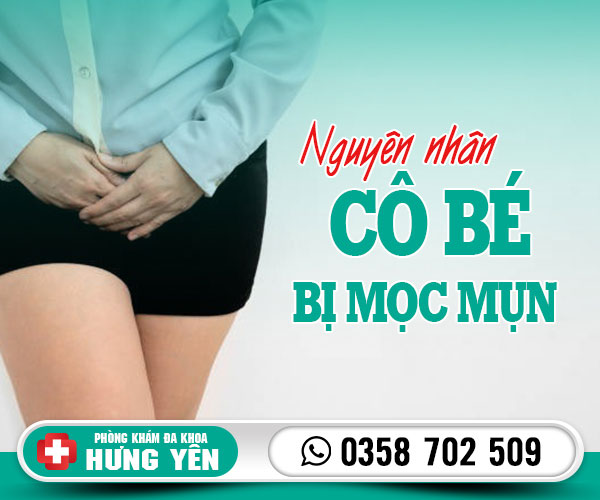 Nguyên nhân cô bé bị mọc mụn