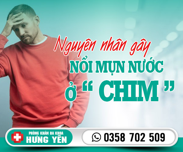 Nguyên nhân gây nổi mụn nước ở chim