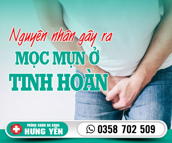 Nguyên nhân mọc mụn ở tinh hoàn