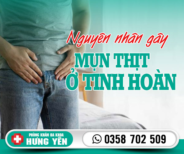 Nguyên nhân gây mụn thịt ở tinh hoàn