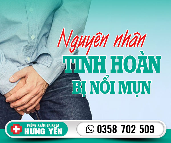 Nguyên nhân tình hoàn bị nổi mụn