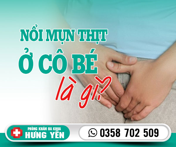 Nổi mụn thịt ở cô bé