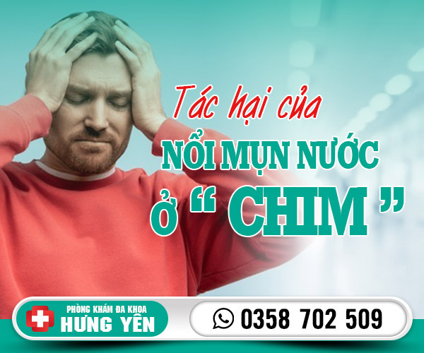 Tác hại của nổi mụn nước ở chim