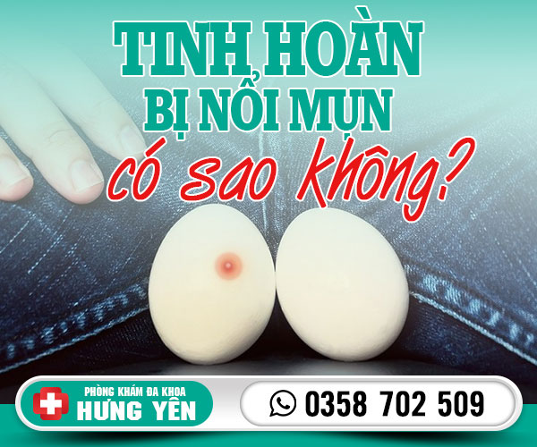 Tinh hoàn bị nổi mụn có sao không