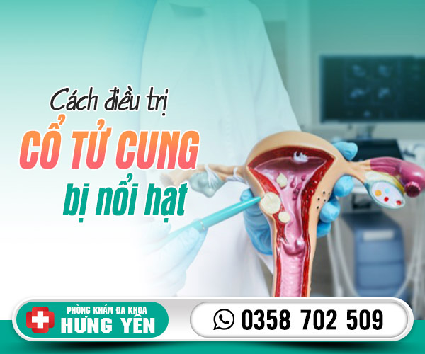 Cách điều trị cổ tử cung bị nổi hạt