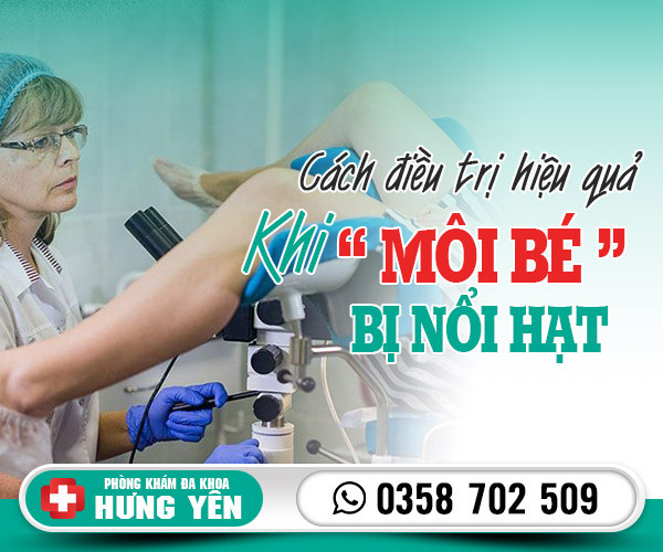 Cách điều trị môi bé bị nổi hạt