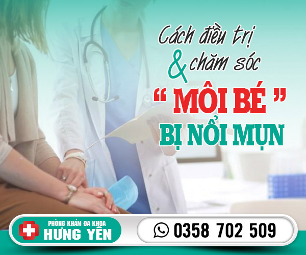 Cách điều trị và chăm sóc môi bé bị nổi mụn