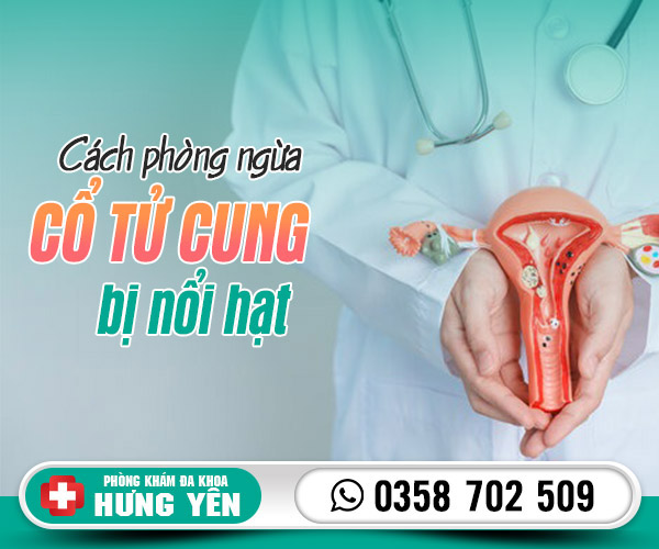 Cách phòng ngừa cổ tử cung bị nổi hạt