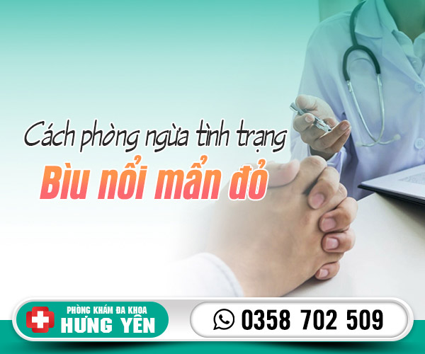 Cách phòng ngừa tình trạng bìu nổi mẩn đỏ