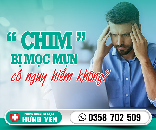 Chim bị mọc mụn có nguy hiểm không