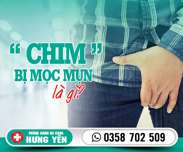 Chim bị mọc mụn là gì