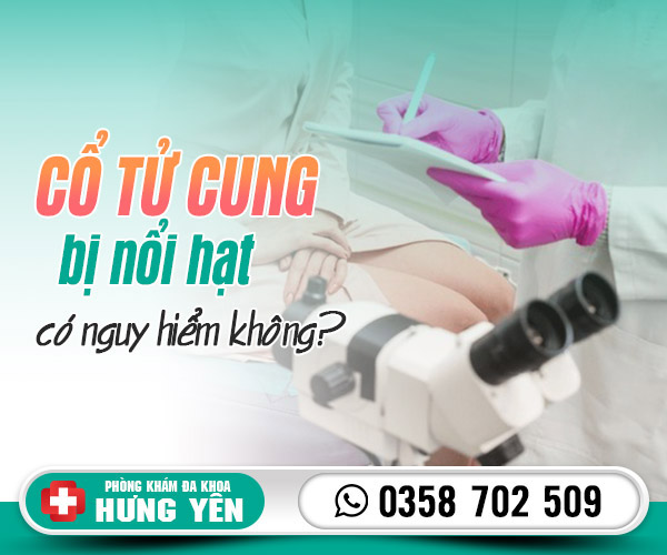 Cổ tử cung bị nổi hạt có nguy hiểm không