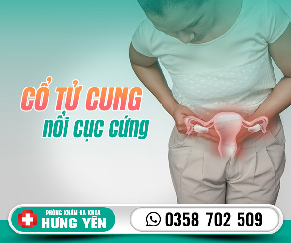 Cổ tử cung nổi cục cứng