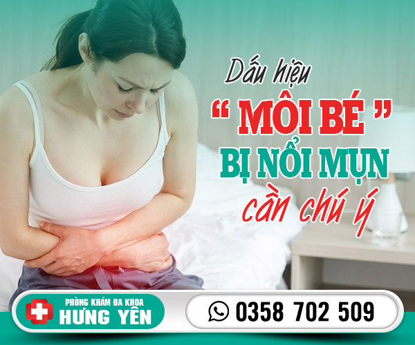 Dấu hiệu môi bé bị nổi mụn