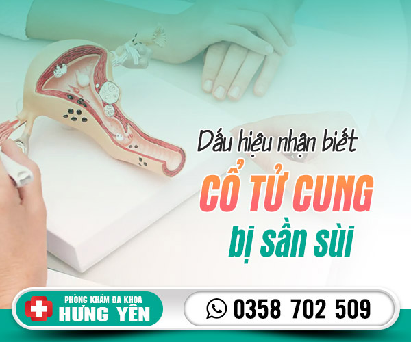 Dấu hiệu nhận biết cổ tử cung bị sần sùi