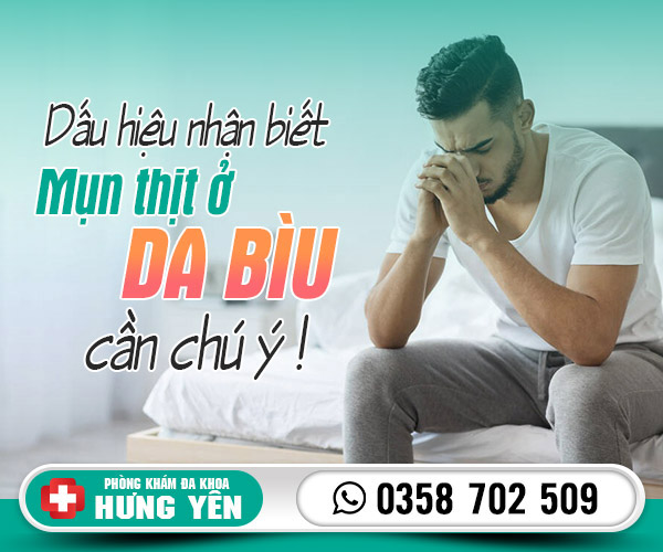 Dấu hiệu mụn thịt ở da bìu cần chú ý