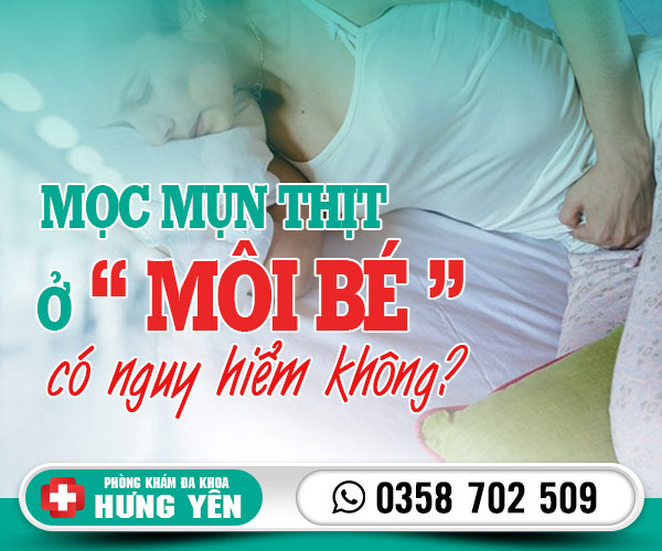 Mọc mụn thịt ở môi bé có nguy hiểm không