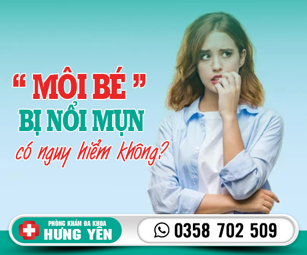 Môi bé bị nổi mụn có nguy hiểm không