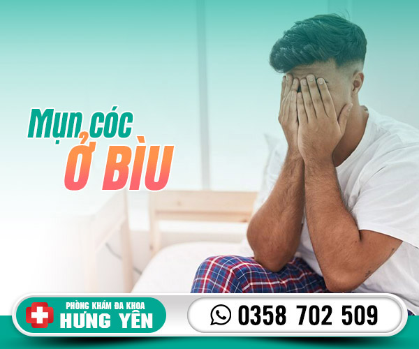 Mụn cóc ở bìu