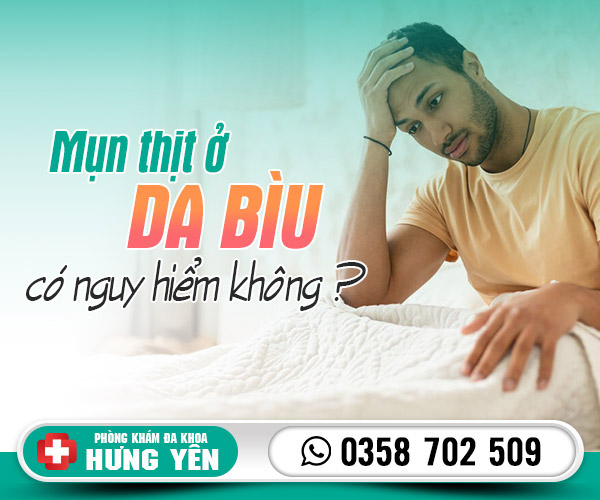 Mụn thịt ở da bìu có nguy hiểm không?