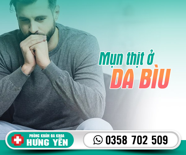 Mụn thịt ở da bìu