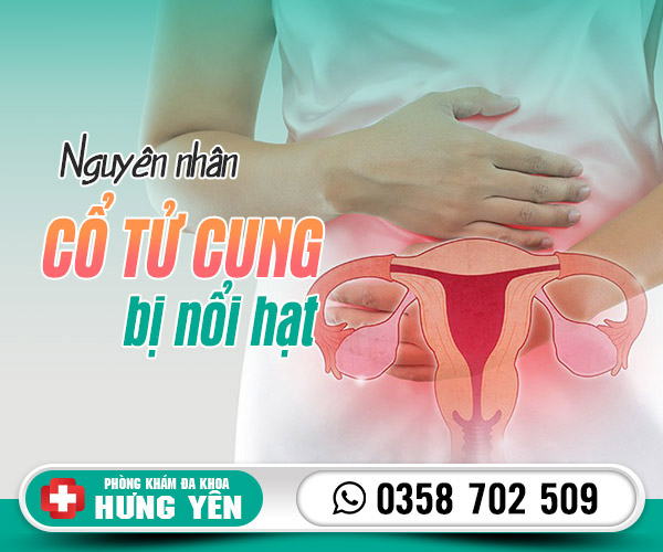 Nguyên nhân cổ tử cung bị nổi hạt