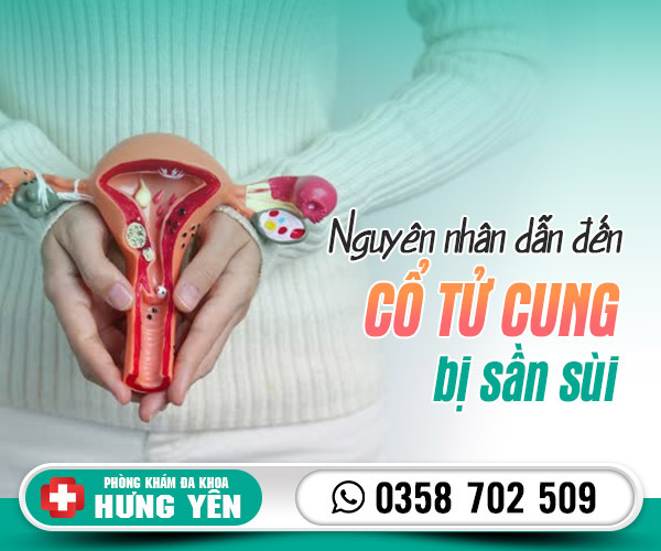 Nguyên nhân cổ tử cung bị sần sùi