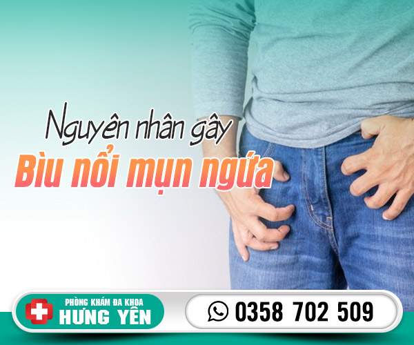 Nguyên nhân gây bìu nổi mụn ngứa