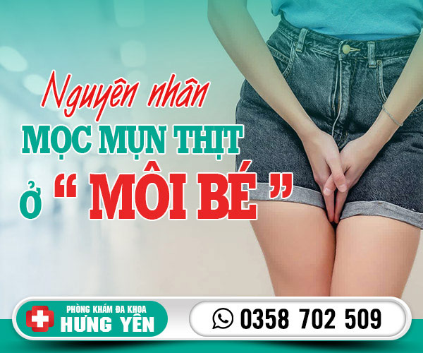 Nguyên nhân mọc mụn thịt ở môi bé