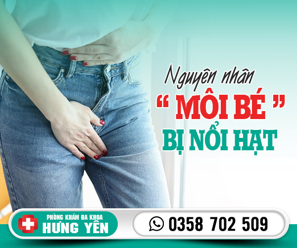 Nguyên nhân môi bé bị nổi hạt