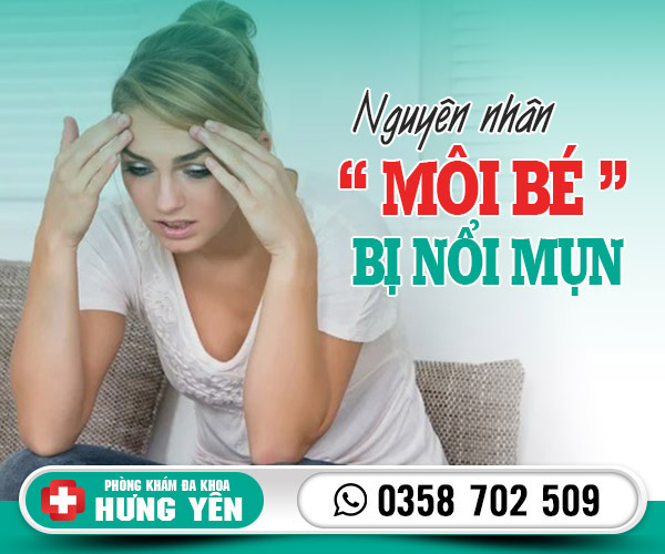 Nguyên nhân môi bé bị nổi mụn