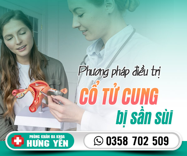 Phương pháp điều trị cổ tử cung bị sần sùi