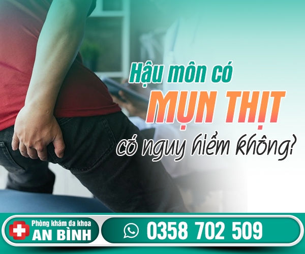 Hậu môn có mụn thịt có nguy hiểm không