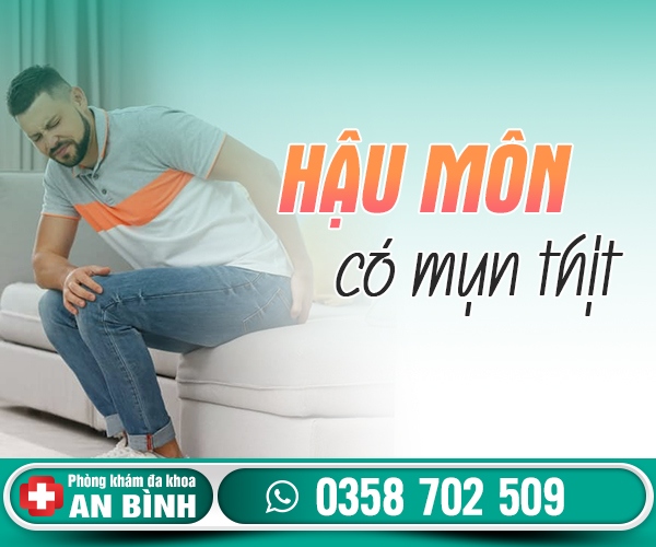 Hậu môn có mụn thịt