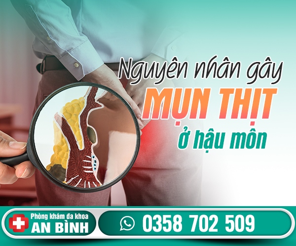 Nguyên nhân hậu môn có mụn thịt