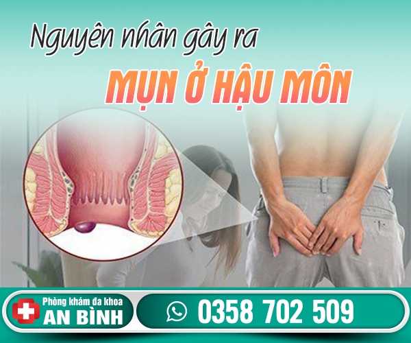 Nguyên nhân mụn ở hậu môn