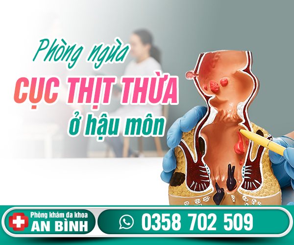 Phòng ngừa cục thịt thừa ở hậu môn
