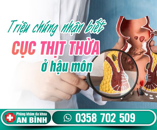 Triệu chứng nhận biết cục thịt thừa ở hậu môn