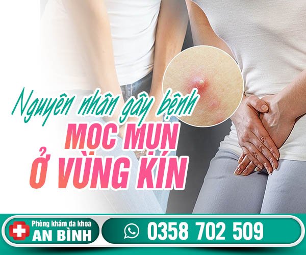 Nguyên nhân mọc mụn ở vùng kín